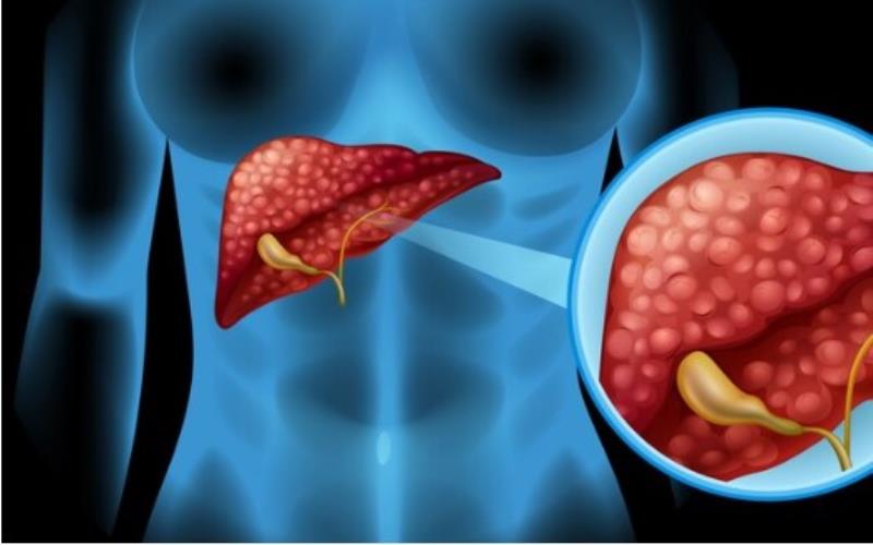 Comprehensive Guide to Pancreatic Cancer Diagnosis & Treatment in Singapor