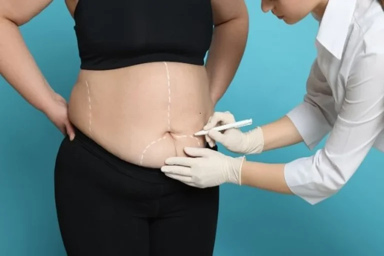 Aesthetic Surgery