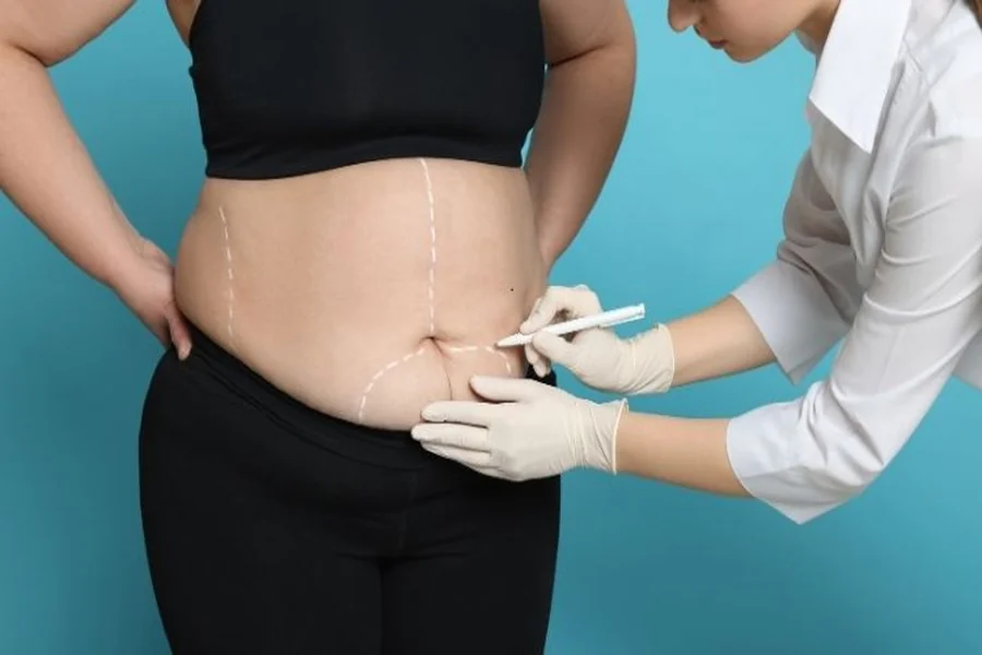Aesthetic Surgery
